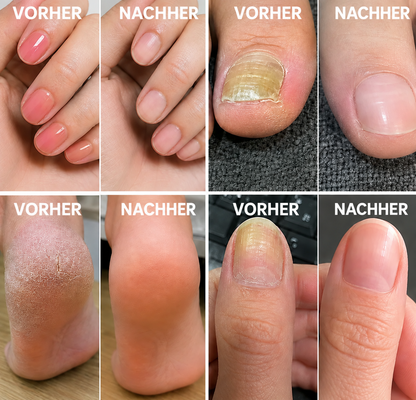 Mresio® Elektrisches Nagelfräser-Set – Digitales Maniküre- & Pediküre-System